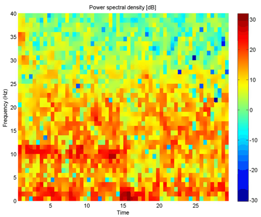 Matlab EEG
                                    Spectrogramexample